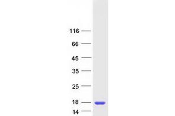 SSNA1 Protein (Myc-DYKDDDDK Tag)