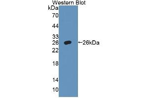 Detection of Recombinant ADD1, Mouse using Polyclonal Antibody to Alpha Adducin (ADD1) (alpha Adducin antibody  (AA 388-560))