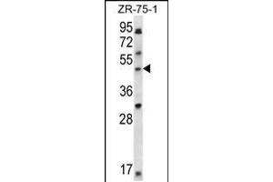 Western blot analysis in ZR-75-1 cell line lysates (35ug/lane). (LIM Domain Binding 1 Protein antibody  (C-Term))