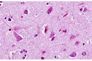 Human, Brain, neurons: Formalin-Fixed Paraffin-Embedded (FFPE) (LGR5 antibody  (Cytoplasmic Domain))