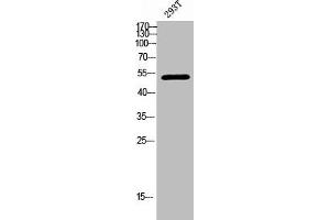 Western Blot analysis of 293T cells using Phospho-Chk1 (S301) Polyclonal Antibody (CHEK1 antibody  (pSer301))