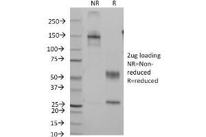 SDS-PAGE Analysis Purified CD7 Mouse Monoclonal Antibody (Clone B-F12). (CD7 antibody)