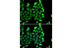 Immunofluorescence analysis of MCF-7 cells using IKZF3 antibody. (IKZF3 antibody)