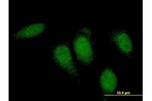 Immunofluorescence of monoclonal antibody to TTN on HeLa cell. (Titin antibody  (AA 1-110))