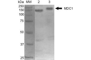 Western Blot analysis of Mouse Cortex and Cerebellum showing detection of 184 kDa MDC1 protein using Mouse Anti-MDC1 Monoclonal Antibody, Clone P2B11 . (MDC1 antibody  (N-Term) (PE))