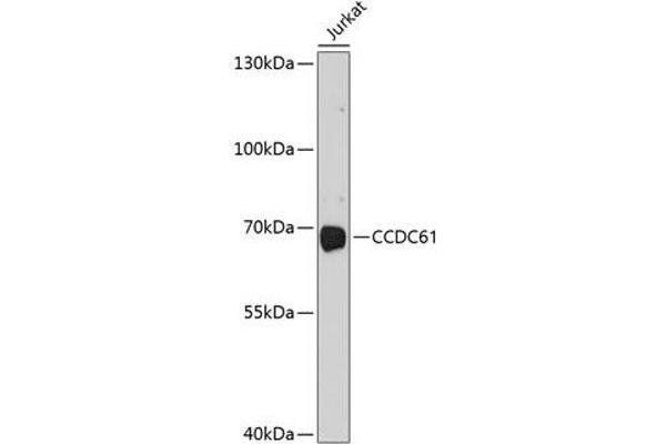 CCDC61 antibody