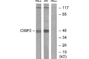 Western blot analysis of extracts from HeLa cells and 293 cells, using CtBP2 antibody. (CTBP2 antibody)