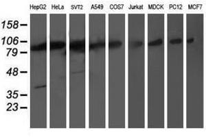 Image no. 2 for anti-Proteasome (Prosome, Macropain) 26S Subunit, Non-ATPase, 2 (PSMD2) antibody (ABIN1500483) (PSMD2 antibody)