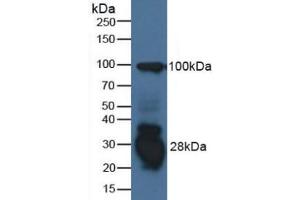 Western blot analysis of Human Raji Cells. (IFI30 antibody  (AA 1-250))