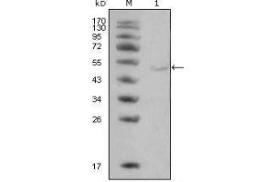 Western blot analysis using LPL mouse mAb against Hela cell lysate (1). (Lipoprotein Lipase antibody)
