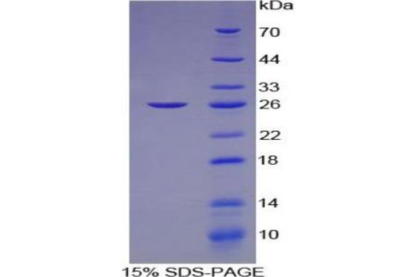 MAP6 Protein