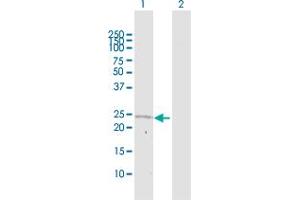 Western Blot analysis of DCXR expression in transfected 293T cell line by DCXR MaxPab polyclonal antibody. (DCXR antibody  (AA 1-244))