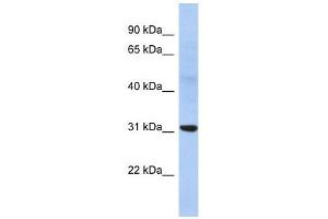 NP antibody used at 1 ug/ml to detect target protein. (NP (Middle Region) antibody)