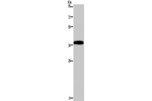 Western Blotting (WB) image for anti-Distal-Less Homeobox 4 (DLX4) antibody (ABIN2429949) (DLX4 antibody)