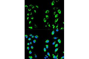 Immunofluorescence analysis of HeLa cells using NFKBIA antibody. (NFKBIA antibody  (AA 1-317))