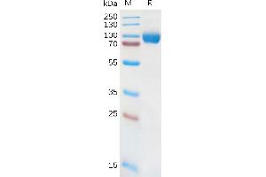 Human IL18RA Protein, hFc Tag on SDS-PAGE under reducing condition. (IL18R1 Protein (AA 19-329) (Fc Tag))