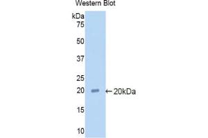 Western blot analysis of the recombinant protein. (alpha 2 Antiplasmin antibody  (AA 348-491))