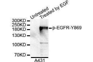 Western blot analysis of extracts of A431 cell lines, using Phospho-EGFR-Y869 antibody. (EGFR antibody  (pTyr845))