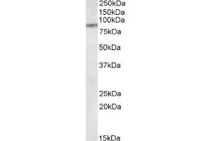 ABIN2560299 (1µg/ml) staining of MCF7 lysate (35µg protein in RIPA buffer). (TAP1 antibody  (Internal Region))