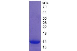 SDS-PAGE (SDS) image for Complement Factor B (CFB) ELISA Kit (ABIN6720575)