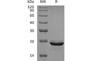 Greater than 95 % as determined by reducing SDS-PAGE. (FGF12 Protein)