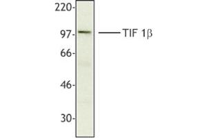 Image no. 1 for anti-Tripartite Motif Containing 28 (TRIM28) antibody (ABIN205483) (KAP1 antibody)