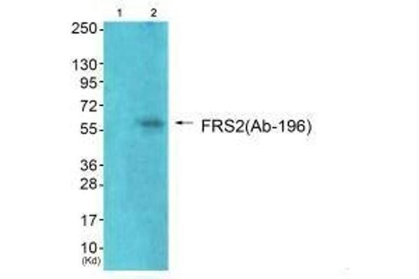 FRS2 antibody  (Tyr196)