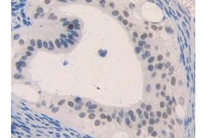 Used in DAB staining on fromalin fixed paraffin- embedded lung tissue (CCL4 antibody  (AA 24-92))