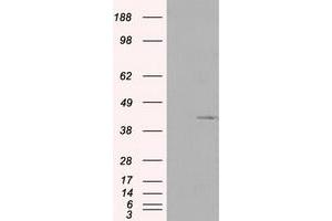 Western Blotting (WB) image for anti-Pleckstrin (PLEK) antibody (ABIN1500265) (Pleckstrin antibody)