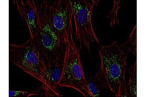 Immunocytochemistry (ICC) image for anti-CD63 (CD63) antibody (ABIN94214)