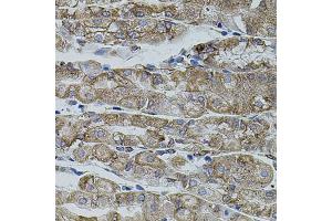 Immunohistochemistry of paraffin-embedded human stomach using SHH antibody (ABIN6291366) (40x lens). (Sonic Hedgehog antibody)