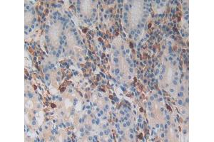 Used in DAB staining on fromalin fixed paraffin- embedded Kidney tissue (MGA antibody  (AA 2450-2733))