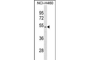 PTEN Antibody (/) (ABIN6242543 and ABIN6577361) western blot analysis in NCI- cell line lysates (35 μg/lane). (PTEN antibody  (AA 361-390))