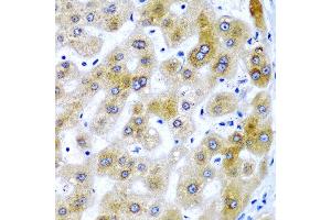 Immunohistochemistry of paraffin-embedded human liver injury using SECISBP2 antibody at dilution of 1:200 (40x lens). (SECISBP2 antibody)