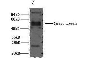 Western Blot analysis of 1) Hela, 2) Mouse brain using CD23 Monoclonal Antibody at dilution of 1:2000. (FCER2 antibody)