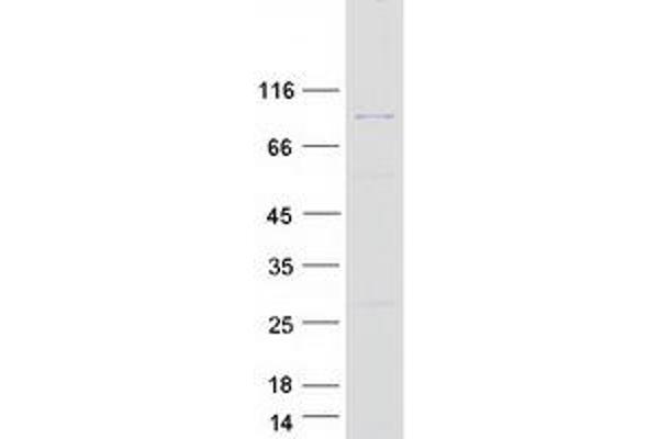 ACAD11 Protein (Myc-DYKDDDDK Tag)