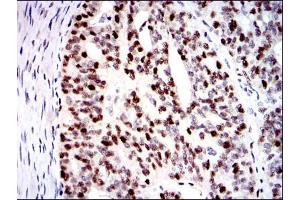 Immunohistochemistry (IHC) image for anti-Minichromosome Maintenance Complex Component 2 (MCM2) antibody (ABIN969281)