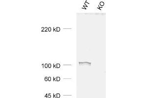 dilution: 1 : 1000, sample: WT and KO samples of mouse cortex (EPS8 antibody)