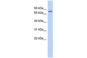 WB Suggested Anti-KLHL14 Antibody Titration:  0. (KLHL14 antibody  (N-Term))