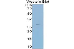 Western Blotting (WB) image for Transferrin (TF) ELISA Kit (ABIN6720523)