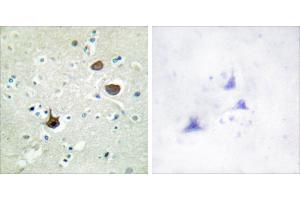 P-peptide - + (CXCR4 antibody  (pSer339))