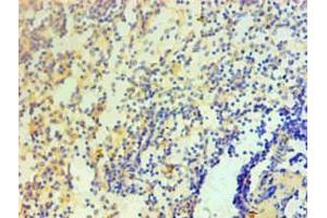 Immunohistochemical of paraffin-embedded Human spleen tissue using ABIN7156047 at dilution of 1:200. (IL1A antibody)