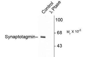 Image no. 2 for anti-Synaptotagmin I (SYT1) (pThr202) antibody (ABIN228043) (SYT1 antibody  (pThr202))