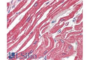 ABIN1590006 (5µg/ml) staining of paraffin embedded Human Heart. (MAPKAP Kinase 2 antibody  (Internal Region))