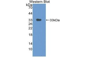 Detection of Recombinant TP, Mouse using Polyclonal Antibody to Thymidine Phosphorylase (TP) (Thymidine Phosphorylase antibody  (AA 29-305))