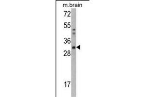 Western blot analysis of CZB Antibody (C-term) 2888b in mouse brain tissue lysates (35 μg/lane). (CAPZB antibody  (C-Term))