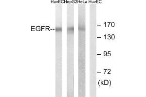 Western Blotting (WB) image for anti-Epidermal Growth Factor Receptor (EGFR) antibody (ABIN1848178) (EGFR antibody)