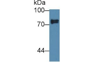 Western Blot; Sample: Human Lung lysate; Primary Ab: 1µg/ml Rabbit Anti-Human SCEL Antibody Second Ab: 0. (SCEL antibody  (AA 519-685))