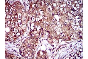 Immunohistochemistry (IHC) image for anti-Interleukin 3 Receptor, alpha (IL3RA) (AA 200-305) antibody (ABIN1724855)