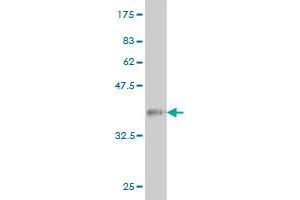 Western Blot detection against Immunogen (36. (Coilin antibody  (AA 477-575))